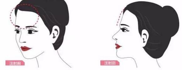 長沙鼻缺損修復(fù)再造大致價(jià)格表參考(長沙梵汐醫(yī)療美容門診部鼻缺損修復(fù)再造參考價(jià)：3749元)