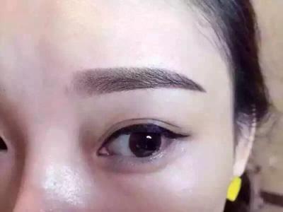 株洲微針美塑祛眼紋費用要好多(株洲美容醫(yī)療美容微針美塑祛眼紋參考價：5092元)