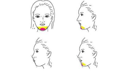 承德打玻尿酸豐眼窩2023價格表供參考(承德中心醫(yī)院打玻尿酸豐眼窩參考價：6943元)