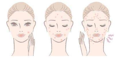 金華美雕祛皺紋價格表明細(xì)上線(浙江大學(xué)金華醫(yī)院整形美容中心美雕祛皺紋參考價：4861元)