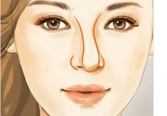 深圳自體脂肪填充唇紋費用項目價格(深圳悅顏醫(yī)療美容醫(yī)院自體脂肪填充唇紋參考價：6367元)