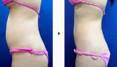 鞍山藥膳去痤瘡治療價格詳細展示(馬鞍山中醫(yī)院醫(yī)療美容科藥膳去痤瘡參考價：3041元)