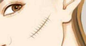 沈陽面部光波拉皮手術一次需要價格是多少費用啊(沈陽圣地亞醫(yī)療美容門診部面部光波拉皮手術參考價：5059元)