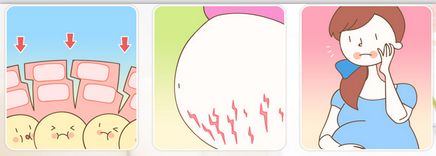 徐州鐳射激光祛斑價(jià)格