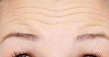 肇慶背部肩部溶脂手術(shù)費(fèi)用驚喜爆出(肇慶柏悅醫(yī)療美容門診部背部肩部溶脂參考價(jià)：3376元)