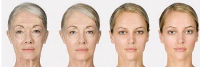 湘潭鼻梁矯正價位表可查看(湘潭前列人民醫(yī)院鼻梁矯正參考價：6322元)