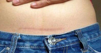 煙臺微創(chuàng)除皺術(shù)價目表get(煙臺愛麗美整形美容門診部微創(chuàng)除皺術(shù)參考價：4998元)