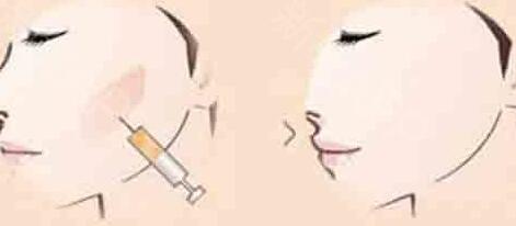 寧波大拉皮去印第安紋收費(fèi)標(biāo)準(zhǔn)趨勢(shì)圖一覽(寧波鄞州新顏元辰醫(yī)療美容診所大拉皮去印第安紋參考價(jià)：4911元)