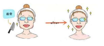 長沙激光眼部除皺法價格怎么樣(長沙貝美整形美容門診部激光眼部除皺法參考價：4620元)