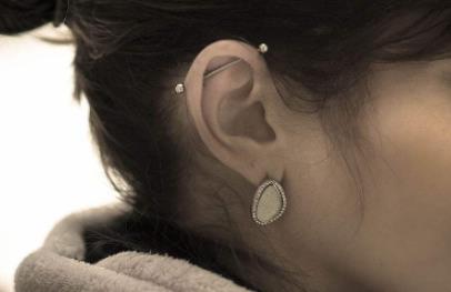 貴州下巴歪斜整形價(jià)格表詳情信息(貴州利康美外科美容醫(yī)院下巴歪斜整形參考價(jià)：6915元)