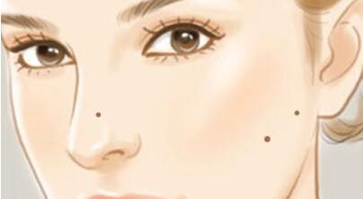 揚州點陣射頻祛抬頭紋的價錢一般要多少錢(揚州邗江施爾美醫(yī)療美容醫(yī)院點陣射頻祛抬頭紋參考價：4355元)