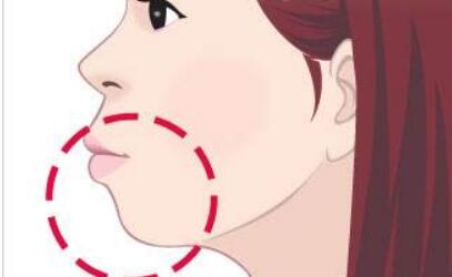 重慶保妥適除皺鼻背紋手術費用2023一覽(重慶中山醫(yī)院整形科保妥適除皺鼻背紋參考價：4006元)