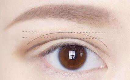 馬鞍山隆下巴整形價(jià)格