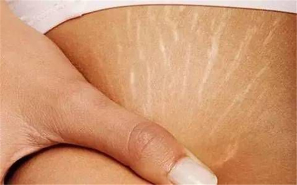 金華像素激光去痘坑治療價格呈現(xiàn)(金華康美醫(yī)療美容醫(yī)院像素激光去痘坑參考價：3452元)