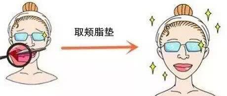 天津共振吸脂祛雙下巴手術(shù)費用(費用明細(xì))(天津第三中心醫(yī)院美容整形科共振吸脂祛雙下巴參考價：5938元)