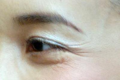 天津外耳再造修復(fù)的報(bào)價(jià)清單(天津藝星醫(yī)療美容醫(yī)院外耳再造修復(fù)參考價(jià)：5846元)