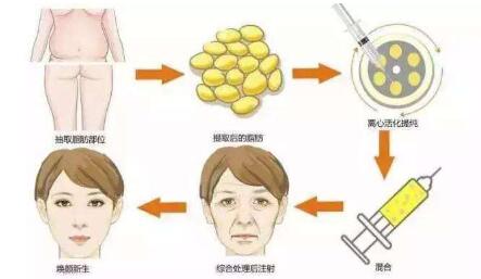 成都微調(diào)整形雙眼皮的報(bào)價(jià)在線查詢(成都百媚生醫(yī)療美容門診部微調(diào)整形雙眼皮參考價(jià)：5913元)
