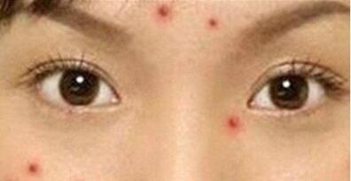 連云港電拉皮激光除皺整形科價目表火熱上線(連云港首爾睿熙整形電拉皮激光除皺參考價：4818元)