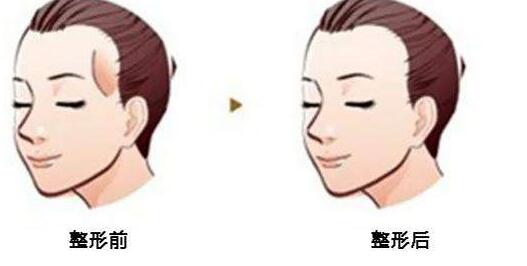 新鄉(xiāng)吸脂針收費(fèi)價(jià)目表剖析(新鄉(xiāng)美天醫(yī)療美容門診部吸脂針參考價(jià)：5611元)