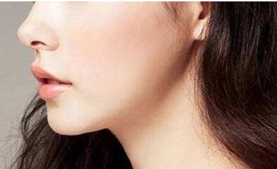 中山法令紋填充脂肪價格