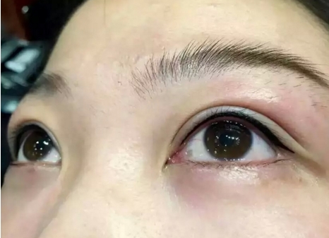 吉安注射墊下巴大概需要手術(shù)費用多少錢(吉安藝星醫(yī)療美容醫(yī)院注射墊下巴參考價：3343元)