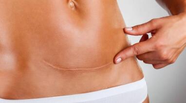 株洲愛貝芙注射魚尾紋價(jià)格