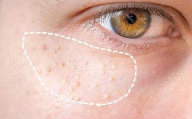 南京生態(tài)翹睫雙眼皮價格表2023版公布(南京美美萊醫(yī)療美容生態(tài)翹睫雙眼皮參考價：4584元)