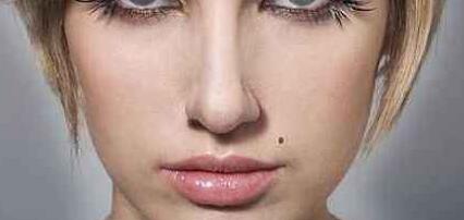 廣元靜態(tài)抬頭紋手術整形價格表全面更新(廣元第一人民醫(yī)院/整形科靜態(tài)抬頭紋手術參考價:3857元)