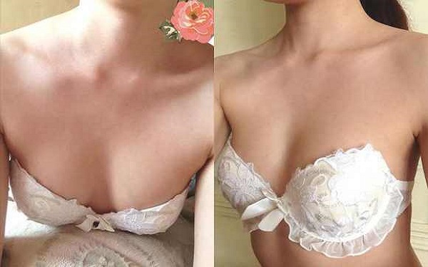 濟(jì)南手術(shù)去除頸紋費用2023全面更新(濟(jì)南韓美整形美容醫(yī)院手術(shù)去除頸紋參考價：5594元)