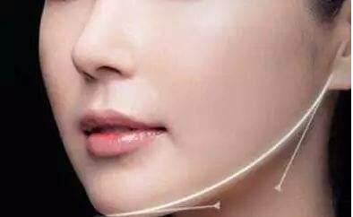 西寧面部3D精雕價(jià)格