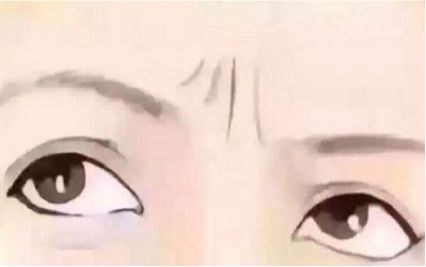 珠海眉間紋微整形一般價(jià)格多少錢(珠海新美匯醫(yī)療美容門診眉間紋微整形參考價(jià)：5742元)