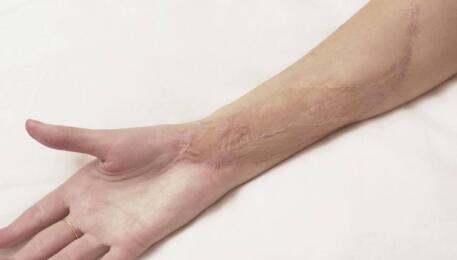 寧波去眼睛細紋手術(shù)的價格大概需要多少錢(寧波童顏依美醫(yī)療美容門診去眼睛細紋手術(shù)參考價：5034元)