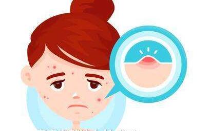 南寧臉部皮膚松弛提升手術(shù)價格表收費費用均價一覽(南寧珍善美醫(yī)療美容診所臉部皮膚松弛提升手術(shù)參考價：4075元)