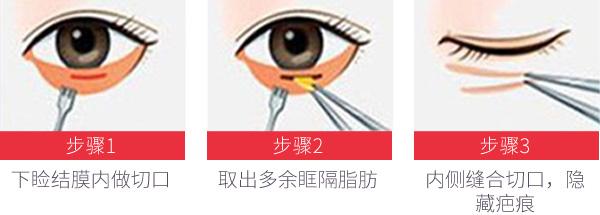 佛山肉毒素美容治療價(jià)目表全新呈現(xiàn)(佛山智媄醫(yī)學(xué)美容門診部肉毒素美容參考價(jià)：5253元)