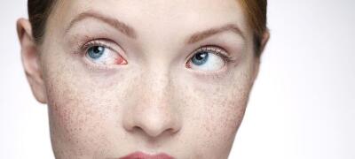 株洲注射器吸脂祛雙下巴一般要價格是多少錢啊(株洲第二醫(yī)院/整形科注射器吸脂祛雙下巴參考價：6927元)