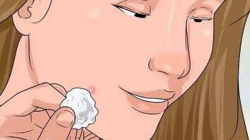 成都精雕去唇紋價格