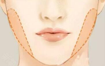 西安藍(lán)寶石冰點(diǎn)脫毛價(jià)格表明細(xì)更新(西安交通大學(xué)第一附屬醫(yī)院整形科藍(lán)寶石冰點(diǎn)脫毛參考價(jià)：6214元)