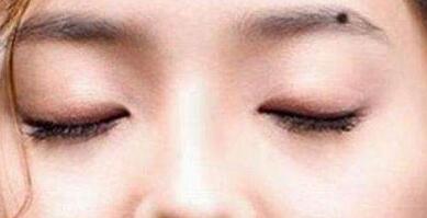 廈門超聲吸脂祛雙下巴價位表收費詳情標(biāo)準(zhǔn)(廈門思明云藝美整形美容門診部超聲吸脂祛雙下巴參考價：3901元)