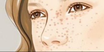 中山眼睛細(xì)紋注射手術(shù)價(jià)格震撼發(fā)布(廣州中山院眼睛細(xì)紋注射參考價(jià)：4560元)