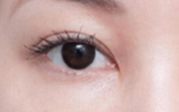 杭州無(wú)痛瘦腿吸脂收費(fèi)價(jià)格表一覽(杭州耀然醫(yī)療美容醫(yī)院無(wú)痛瘦腿吸脂參考價(jià)：5189元)