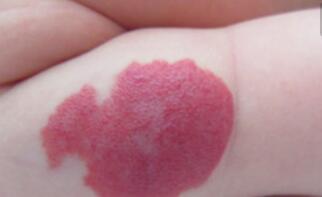 阜陽(yáng)等離子溶脂瘦臉價(jià)目表2023版均價(jià)公布(阜陽(yáng)陽(yáng)均醫(yī)療美容醫(yī)院等離子溶脂瘦臉參考價(jià)：4623元)