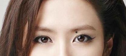 洛陽(yáng)印第安紋線雕提升價(jià)位查詢(洛陽(yáng)毛大夫醫(yī)療美容門診部印第安紋線雕提升參考價(jià)：3326元)