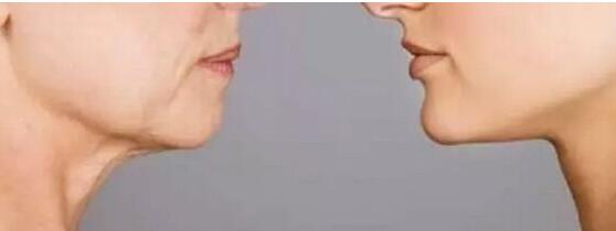 桂林下巴凹陷疤痕微針治療價(jià)格2023新版全網(wǎng)發(fā)布(桂林諾瀾登整形美容診所下巴凹陷疤痕微針參考價(jià)：5658元)