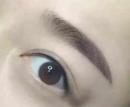 青海妊娠紋填充注射費用清單查詢(青海省人民醫(yī)院妊娠紋填充注射參考價：6452元)