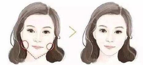 鄭州微整形頸部皺紋2023價目表在線公布(鄭州第六人民醫(yī)院整形科微整形頸部皺紋參考價：3567元)