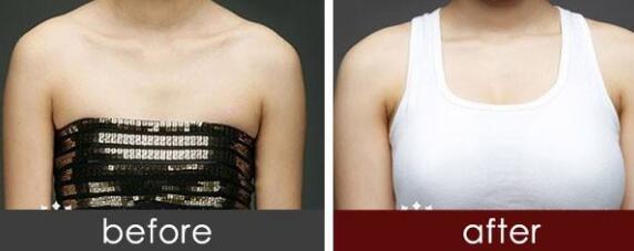 武漢小腿射頻溶脂的價(jià)格是多少查詢?nèi)缦?武漢第二醫(yī)院整形外科小腿射頻溶脂參考價(jià)：5637元)