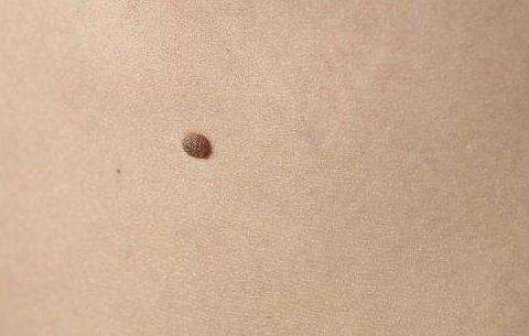 齊齊哈爾射頻吸脂瘦腿價格多不多(齊齊哈爾建華醫(yī)院整形外科射頻吸脂瘦腿參考價：4869元)