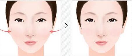 西安膠原蛋白注射豐唇部的報價在線查詢(西安童顏堂整形美容醫(yī)院膠原蛋白注射豐唇部參考價：4387元)