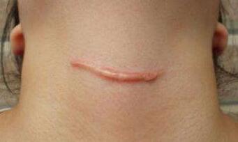 包頭面部五官塑型的費(fèi)用大概需要多少價(jià)格(包頭尹麗霞醫(yī)學(xué)美容診所面部五官塑型參考價(jià)：6928元)