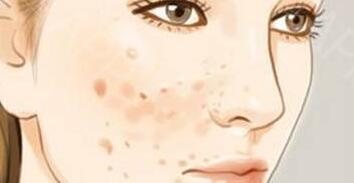 深圳膠原蛋白隆眉弓價格表送上(深圳悅她醫(yī)療美容整形醫(yī)院膠原蛋白隆眉弓參考價：4252元)